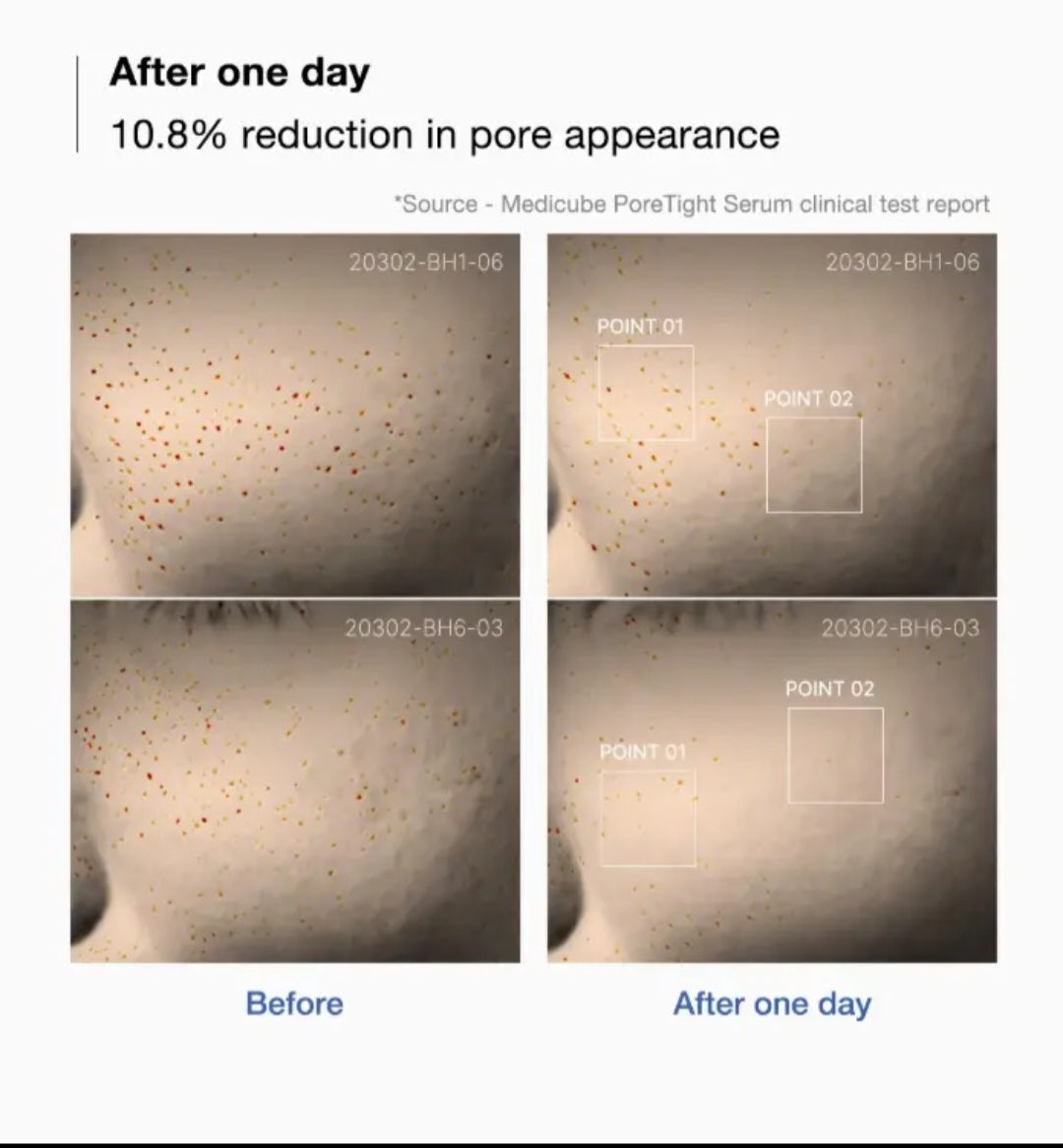 Medicube Zero Pore One Day Serum